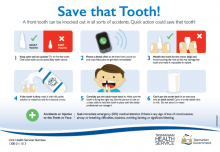 Save that Tooth!