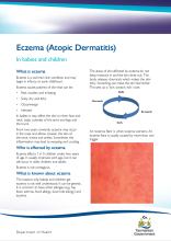 Thumbnail image of the Eczema in babies and children fact sheet