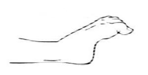 A drawn foot diagram showing toes curling under.