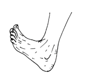 A drawn foot diagram with the toes pointing upwards.
