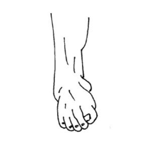 A drawn diagram of a foot with the foot being twisted outwards away from the body.