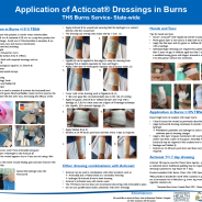 Thumbnail image of the Application of Acticoat in Burns Poster