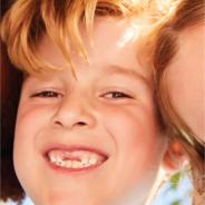 Image of teenage boy smiling while missing his top front two teeth